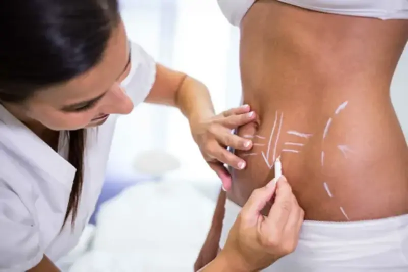 Depilação a laser torax e abdomen